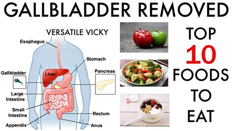 Overcoming the Challenges of Eating Greasy Food After Gallbladder Removal